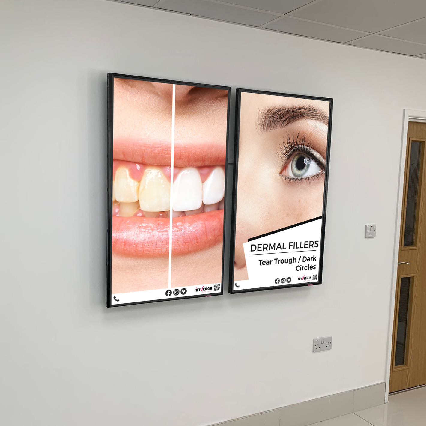 peach dental teeth whitening and dermal filler adverts on internal screens